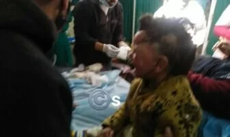 Hospital Cylinder Blast: Eleven persons including mother-daughter duo sustain burn injuries, One employee referred to Srinagar hospital